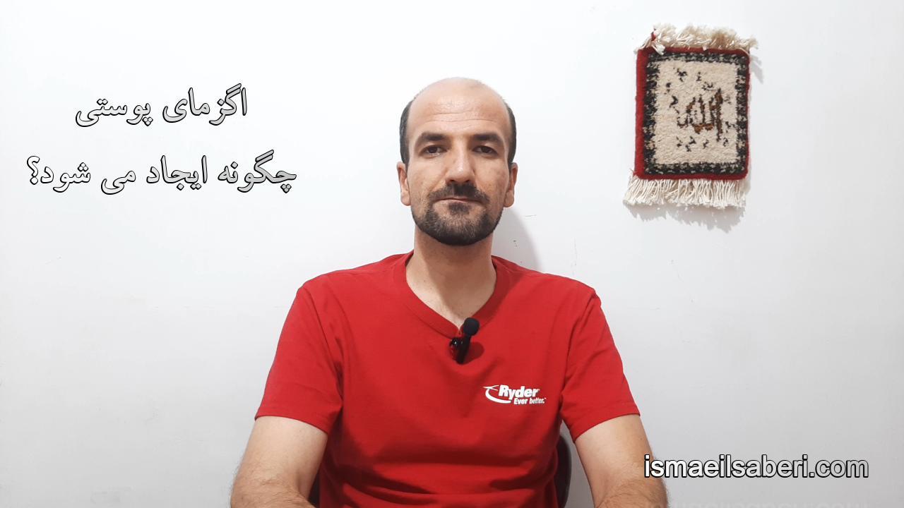 اگزمای پوستی چگونه ایجاد می شود؟