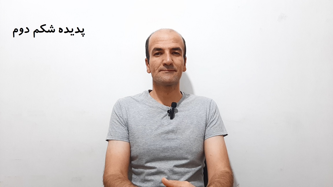 پدیده شکم دوم