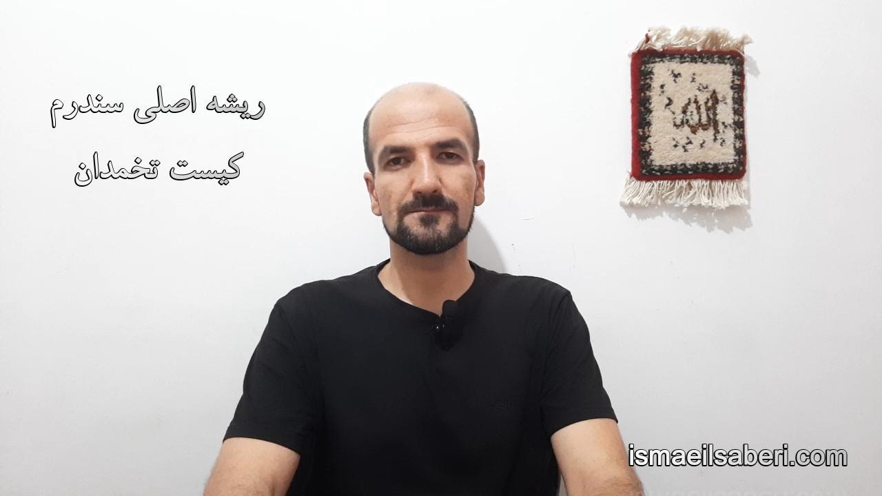 ریشه اصلی سندرم کیست تخمدان