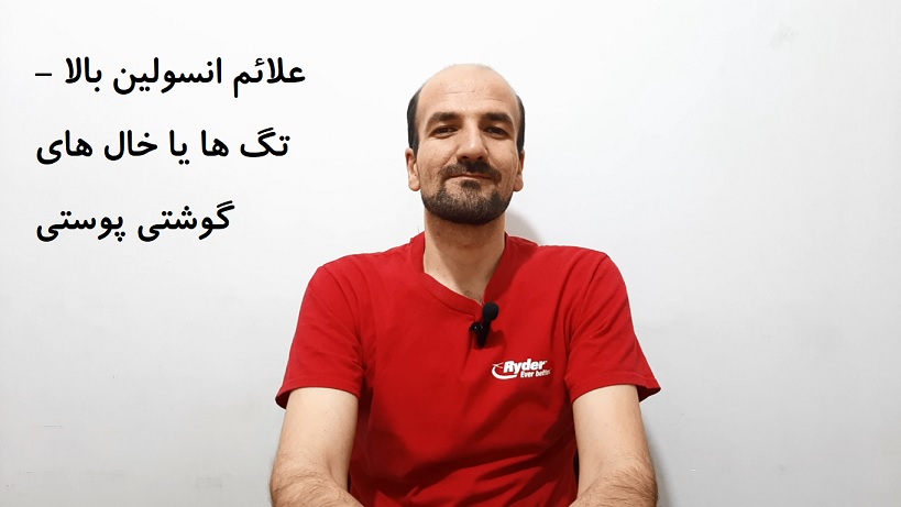 علائم انسولین بالا - تگ ها یا خال های گوشتی پوستی
